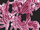 Tuberkulose ist trotz des niedrigen Vorkommens noch ein Thema.