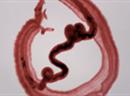In der Studie wurden die Verursacher der Bilharziose, die Schistosoma-Würmer, herangezogen.(Archivbild)